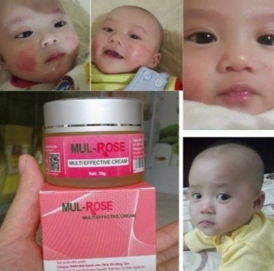 Kem Mul Rose