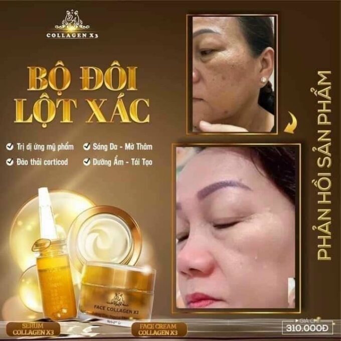 Serum Trị Nám, Thâm Mụn Collagen X3 Đông Anh