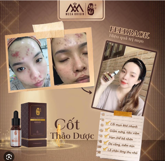 Serum Cốt Huyết Thanh Thảo Dược 36 Vị 100ml